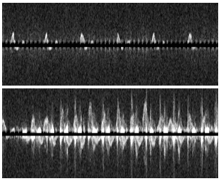 First ultrasound data from SonoFit prototype!