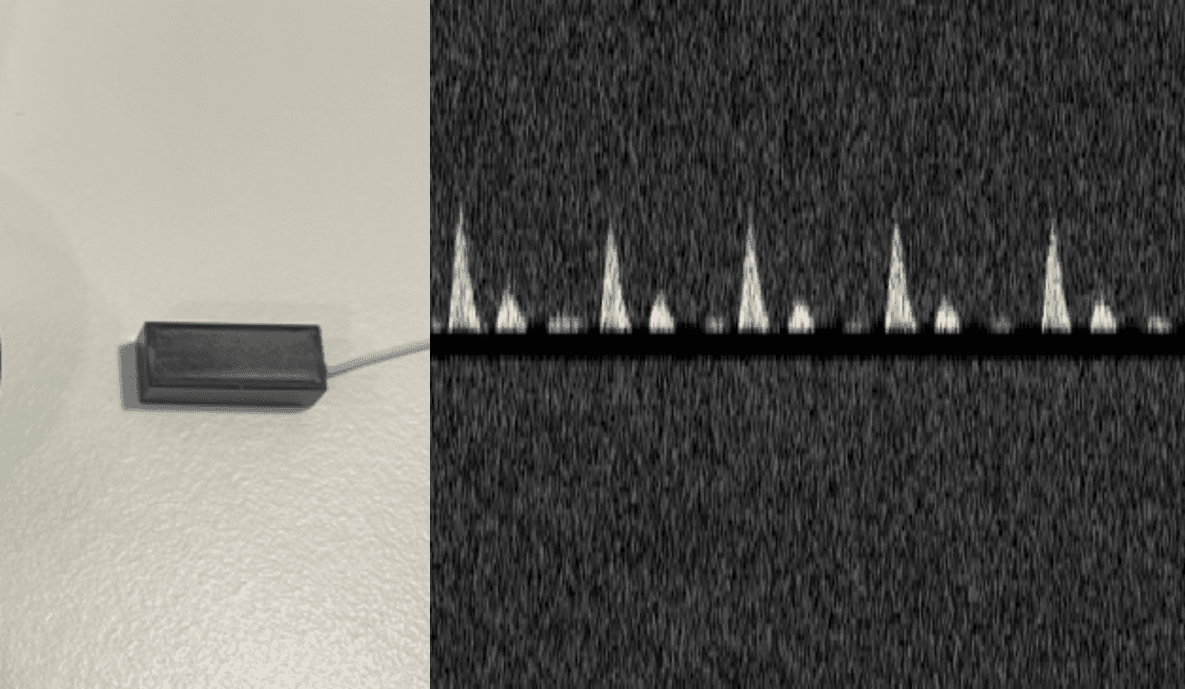 Technical milestone achieved with in-house ultrasound transducers!